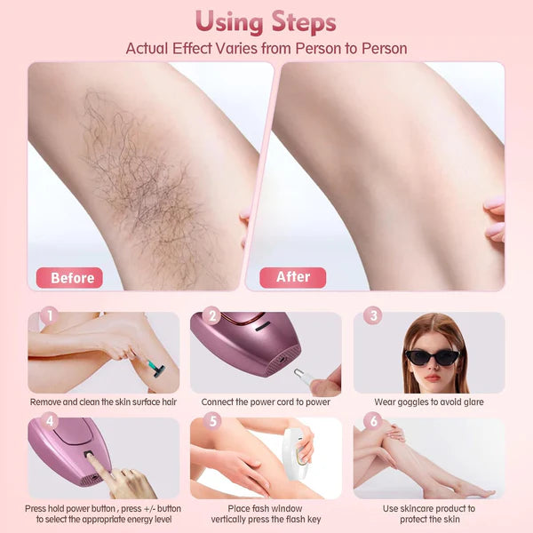 Laser Hair Removal Device for Women